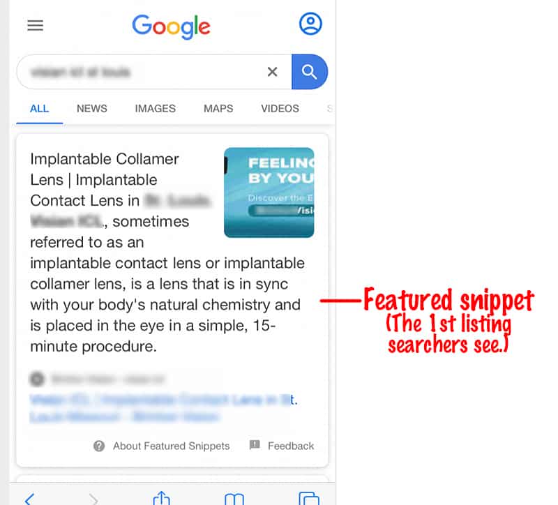 Google Featured Snippet Change